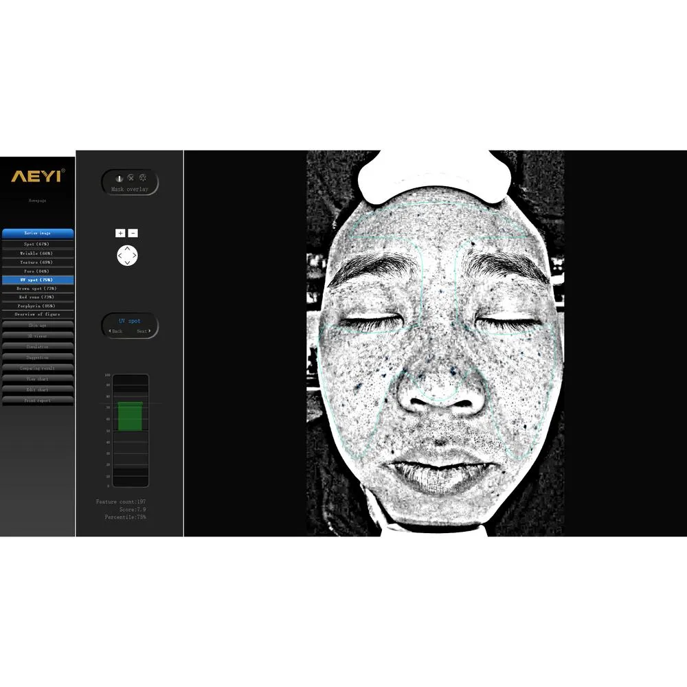 Rishi Advanced Digital Skin Analyzer by Meishida