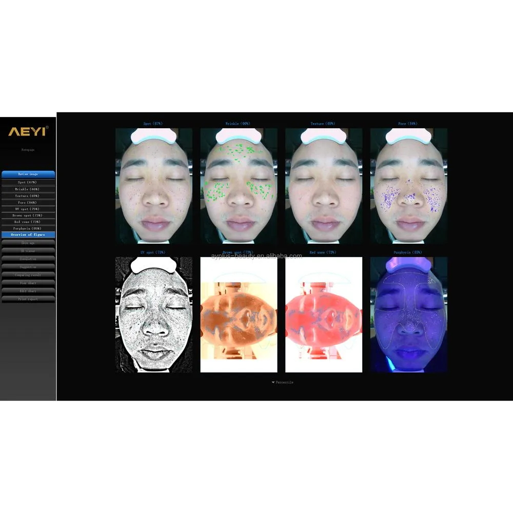 Rishi Advanced Digital Skin Analyzer by Meishida