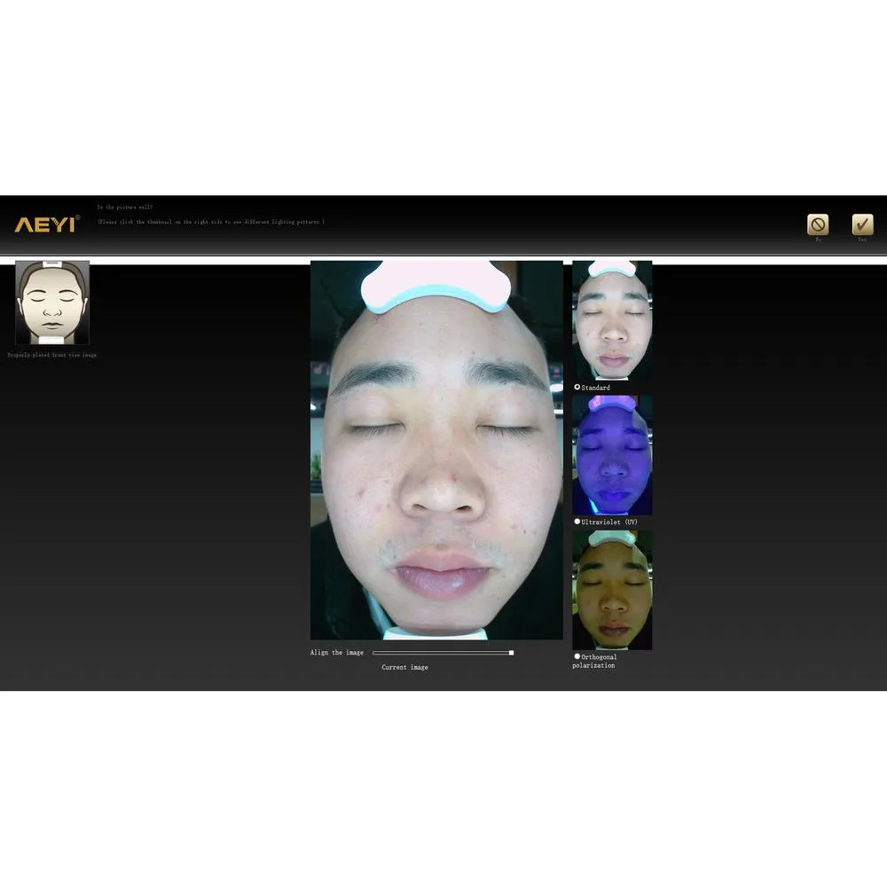Rishi Advanced Digital Skin Analyzer by Meishida