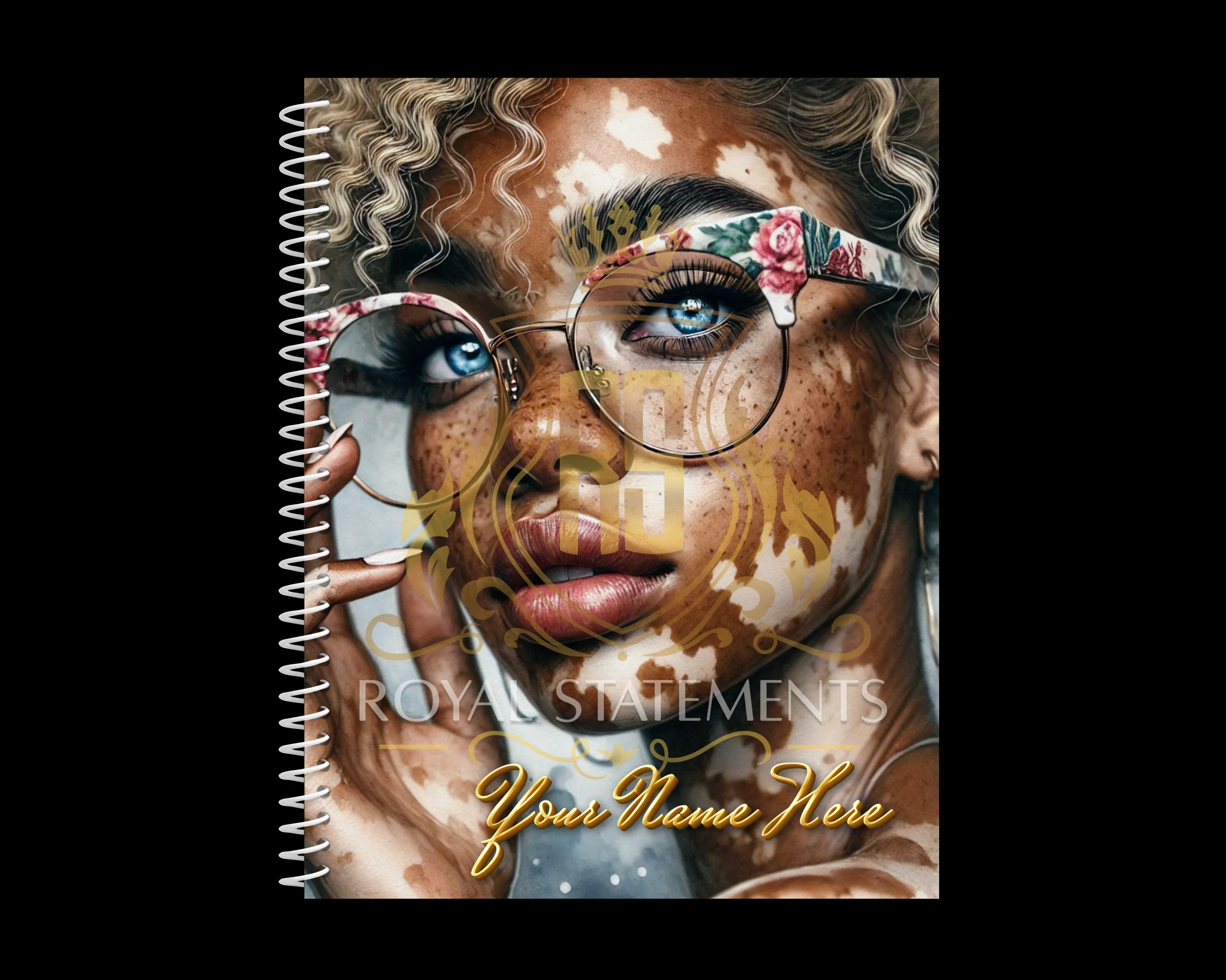 Vitiligo Visions Notebook Collection